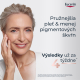 Eucerin Hyaluron-Filler + Elasticity Rosé SPF 30 50ml